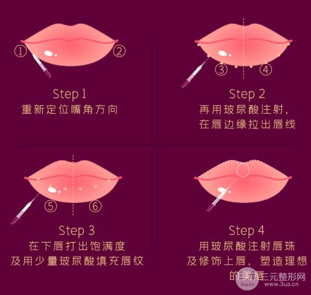 手术护理