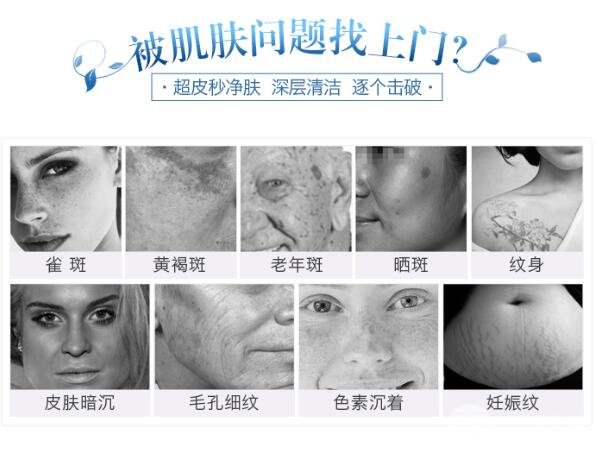 盘点三甲医院皮肤科祛斑常用到的仪器！
