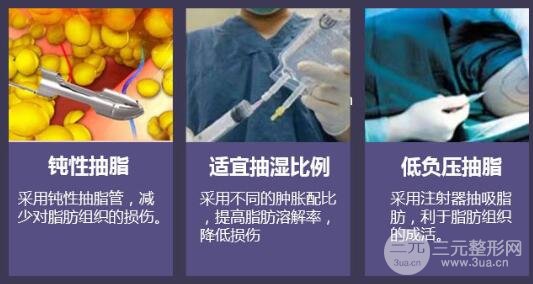 术简介