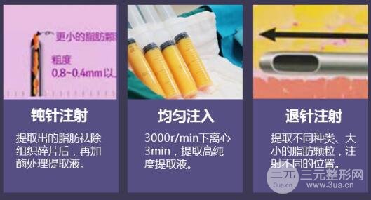 术简介