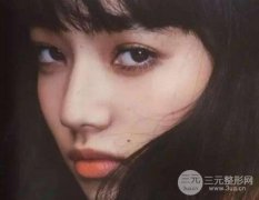 想知道膨体隆鼻手术多少钱?戳进来! 想知道膨体隆鼻手术多少钱?戳进来!