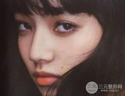 想知道膨体隆鼻手术多少钱?戳进来!