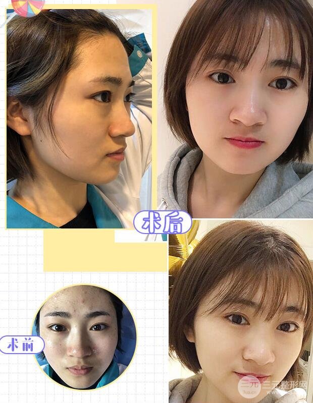 黑脸娃娃果图