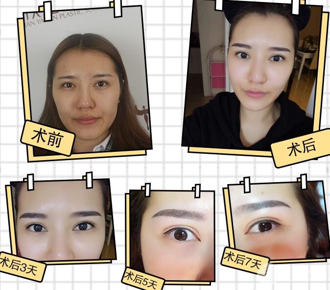 纹眉果图