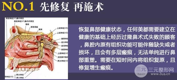 隆鼻失败别恐慌，修复手术成功的几率还是很大的！