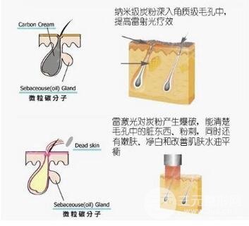 瓷娃娃原理