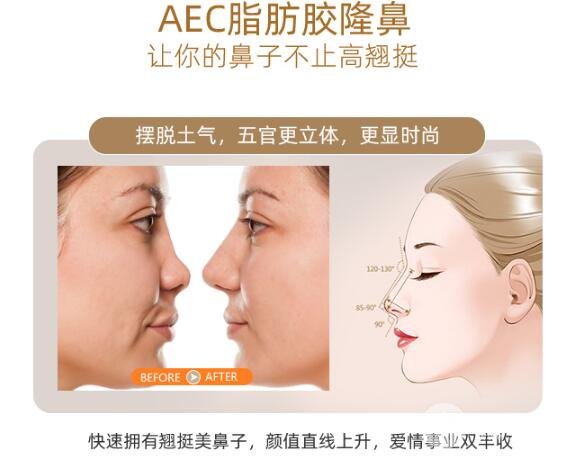 自体脂肪隆鼻优缺点