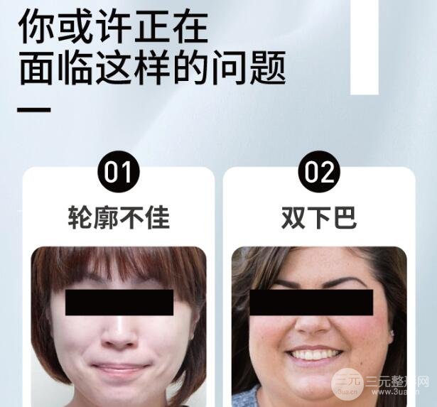 面颊吸脂多久完全消肿?