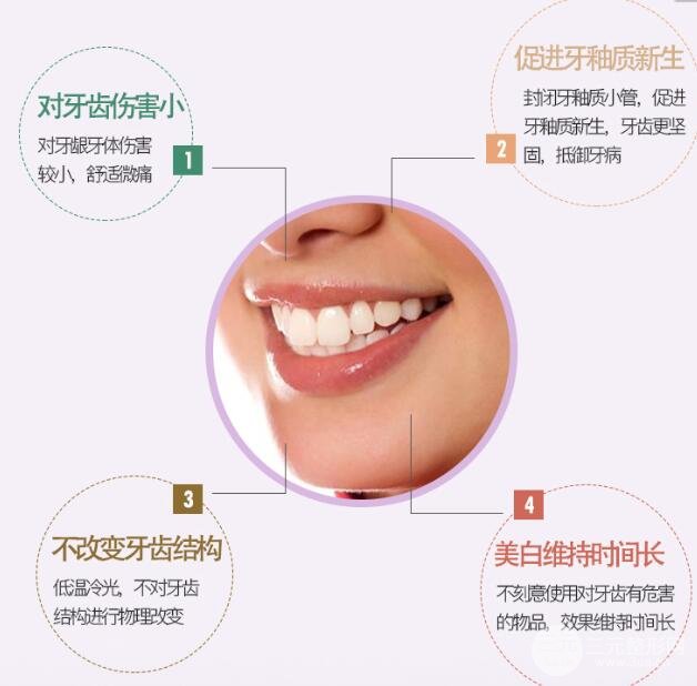 牙齿冷光美白多少钱?