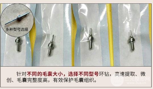 什么是毛发种植?