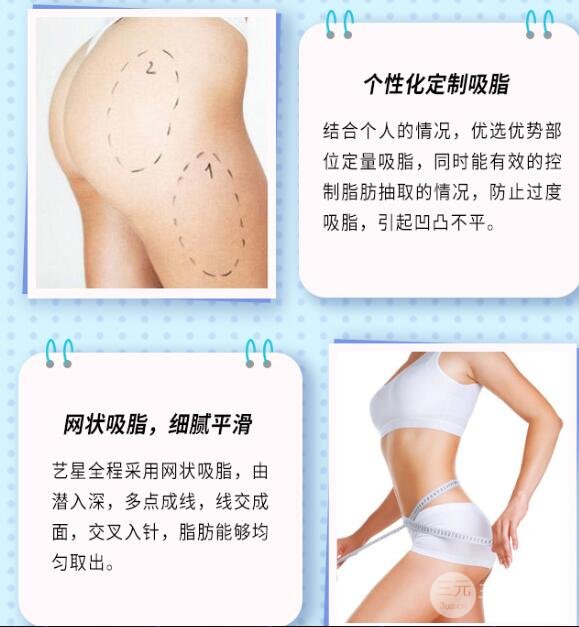 大腿抽脂多少钱?