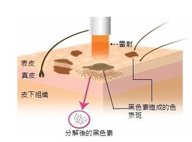 祛斑的方法