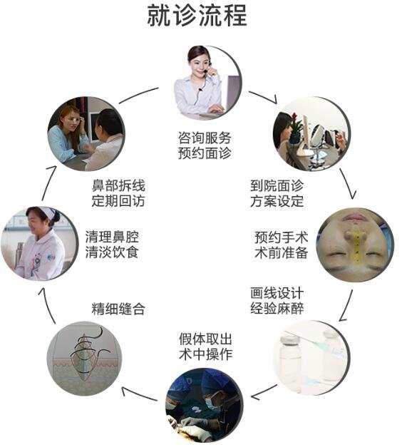 鼻部整形后的护理