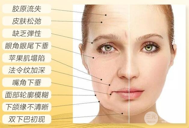热玛吉第三代的果不好?看了图片可能会打脸!