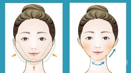 光纤溶脂瘦脸适合人群