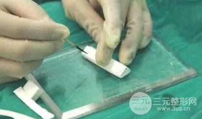 膨体隆鼻多少钱?