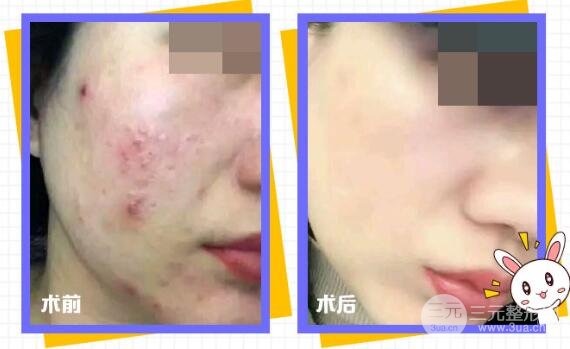 复合彩光成好吗？