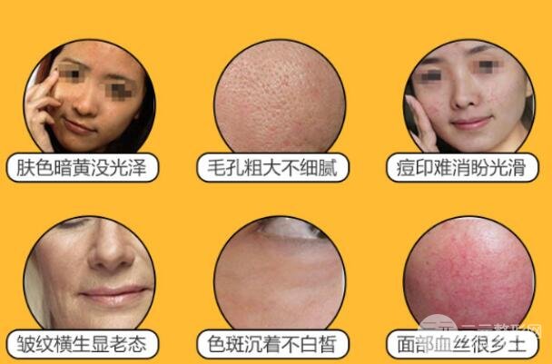 复合彩光对肌肤有哪些帮助？