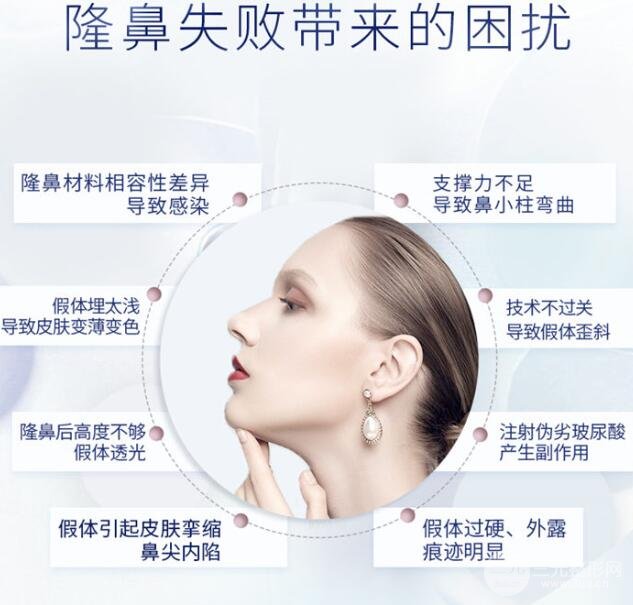 鼻子修复术选择什么材料?