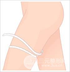 吸脂瘦大腿肿胀期是多久？做好术后护理可以缩短时间~