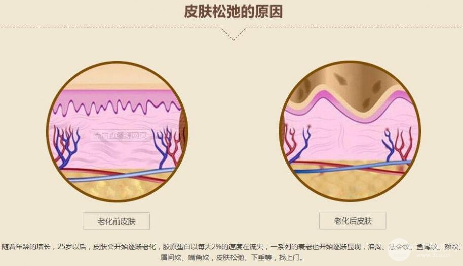 去除抬头纹价格?