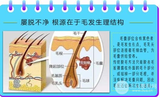 面部长时间性脱毛方式