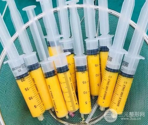 脸部自体脂肪填充价格多少？受到几点因素影响哦~