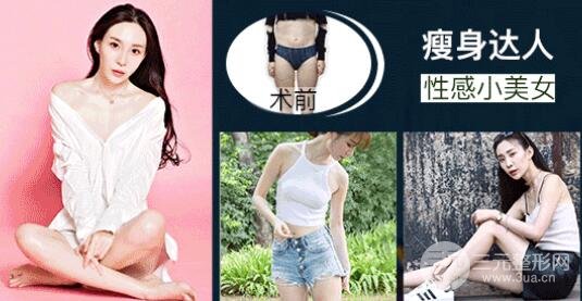 腹部吸脂手术后的注意事项