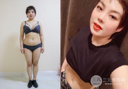 腹部吸脂手术风险如何避免?