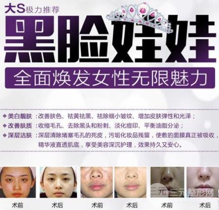 黑脸娃娃去黑头价格曝光，原来美肤这么简单？！