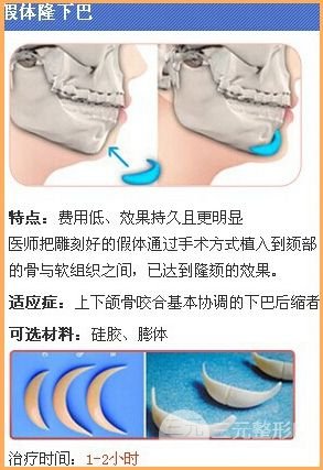 整下巴价格解析:假体or玻尿酸应该如何选择?