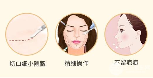 磨骨手术真的很可怕吗?