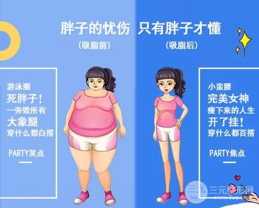 大腿吸脂手术选择医院很重要