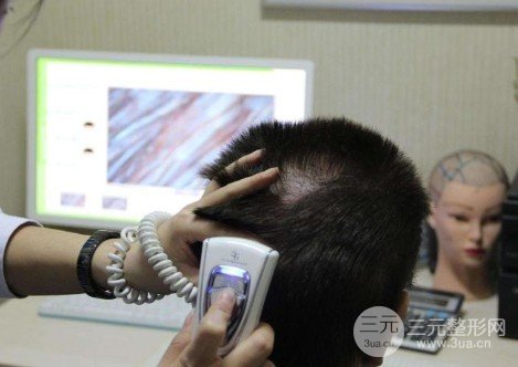 佛山市一能做毛囊檢測(cè)嗎