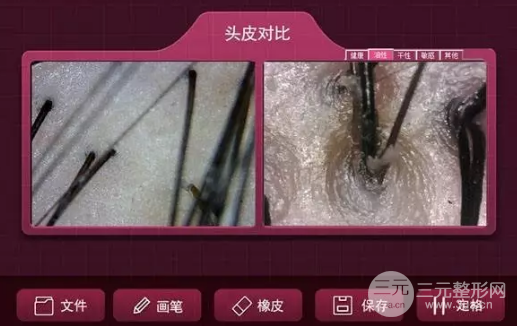 佛山市一能做毛囊檢測(cè)嗎