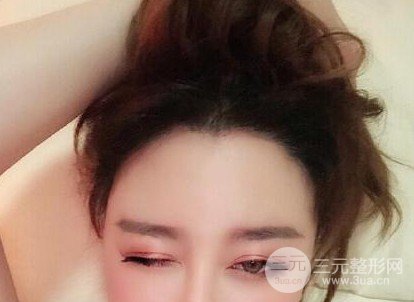 南方醫(yī)科大學(xué)南方醫(yī)院植發(fā)果圖