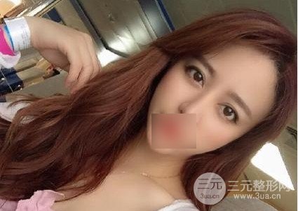 南方醫(yī)科大學(xué)南方醫(yī)院植發(fā)果圖