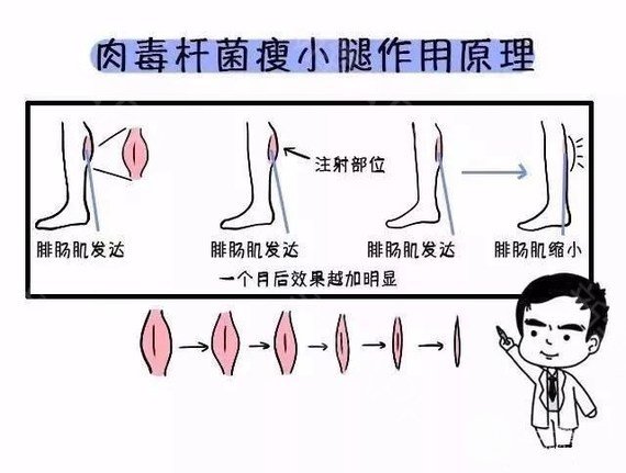 注射瘦腿的价格来咯!夏天美腿利器,赶紧get起来!