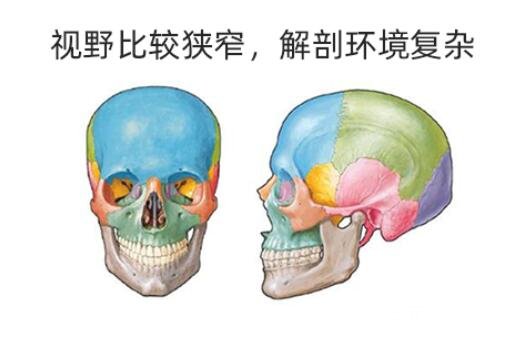 颧骨内推手术失败了怎么办?