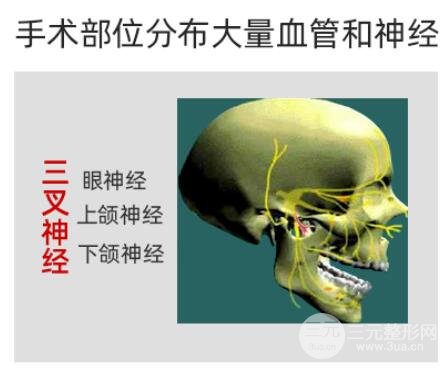 颧骨内推手术失败了怎么办?