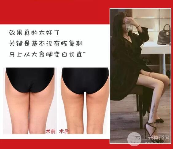 如何避免手术风险?
