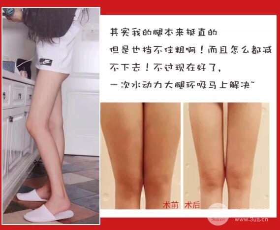 如何避免手术风险?
