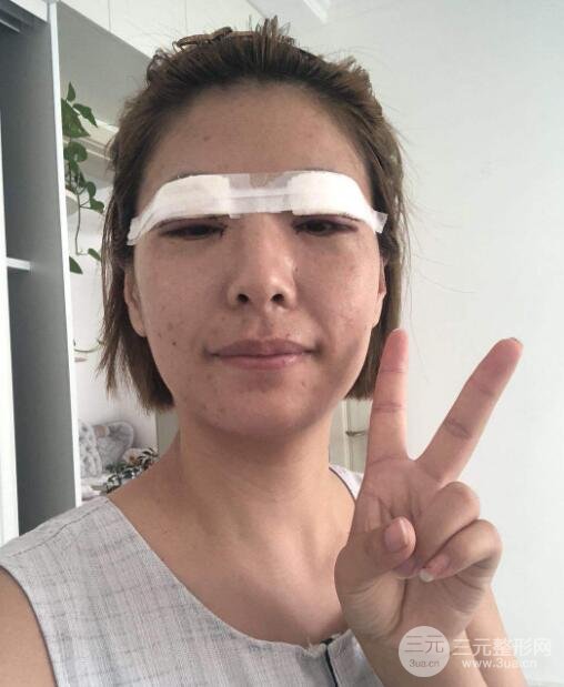 柳州人民醫(yī)院整形案例