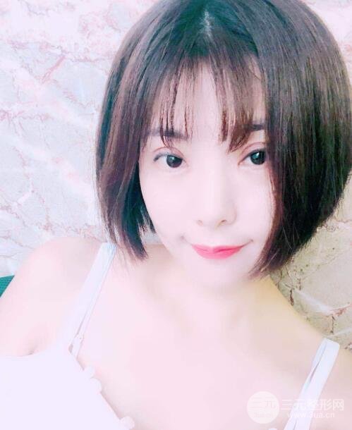 柳州人民醫(yī)院整形案例