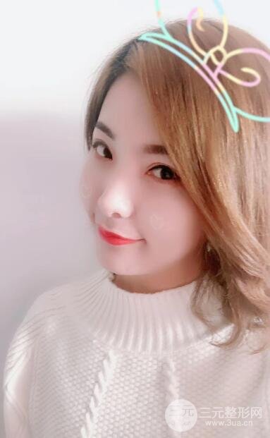 柳州人民醫(yī)院雙眼皮