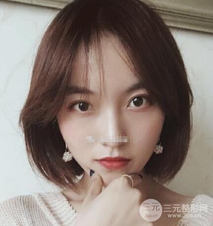 下頜骨切除案例