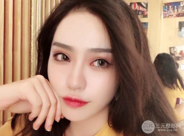 上海九院钱云良做的双眼皮好吗价格表是怎样的