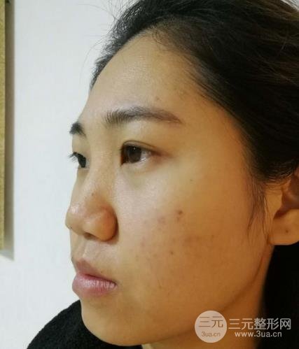 #掌握#廈門第一醫(yī)院美容科有哪些項目？收費情況+整形案例~