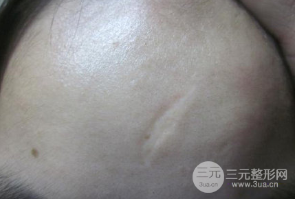 漳州市醫(yī)院整形美容科主任