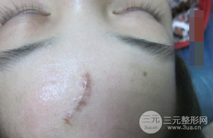 漳州市醫(yī)院整形美容科主任